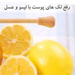 رفع لک های پوست با لیمو و عسل